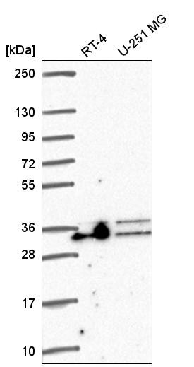 Western blot analysis in human cell line RT-4 and human cell line U-251 MG.
