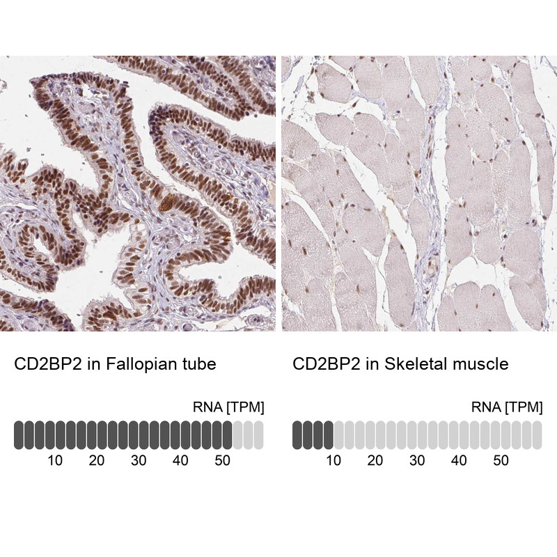 Immunohistochemistry analysis in human fallopian tube and skeletal muscle tissues using Anti-CD2BP2 antibody. Corresponding CD2BP2 RNA-seq data are presented for the same tissues.