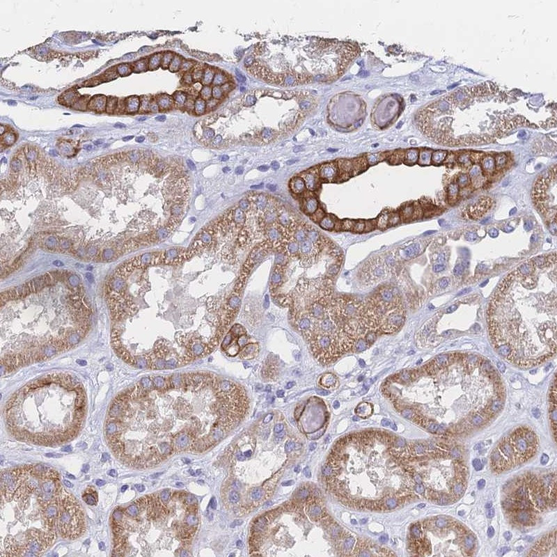 Immunohistochemical staining of human kidney shows strong cytoplasmic and membranous positivity in cells in tubules.