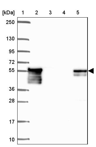 Lane 1: Marker [kDa] 250, 130, 95, 72, 55, 36, 28, 17, 10<br/>Lane 2: Human cell line RT-4<br/>Lane 3: Human cell line U-251 MG<br/>Lane 4: Human plasma<br/>Lane 5: Human Liver tissue