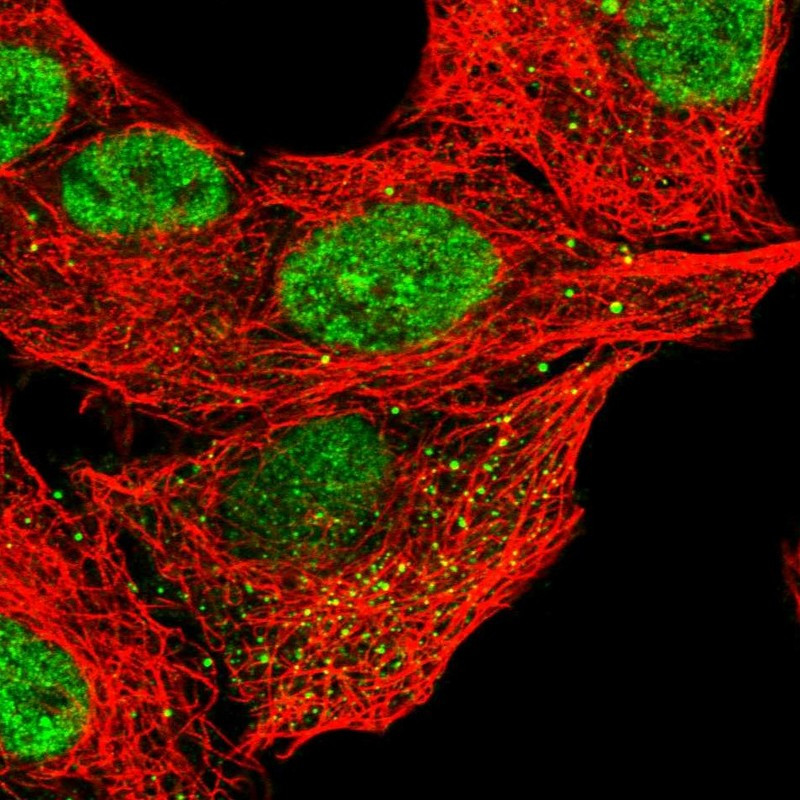 Immunofluorescent staining of human cell line A549 shows localization to nucleoplasm & vesicles.