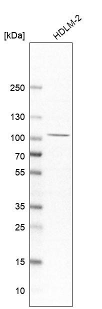 Western blot analysis in human cell line HDLM-2.