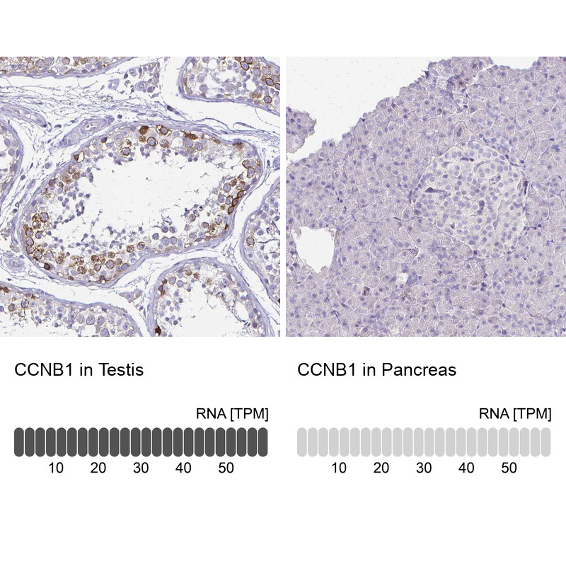 Immunohistochemistry analysis in human testis and pancreas tissues using Anti-CCNB1 antibody. Corresponding CCNB1 RNA-seq data are presented for the same tissues.