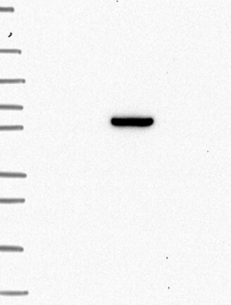 Lane 1: Marker [kDa] 250, 130, 95, 72, 55, 36, 28, 17, 10 | Lane 2: RT4 | Lane 3: U-251 MG | Lane 4: Human Plasma | Lane 5: Liver | Lane 6: Tonsil
