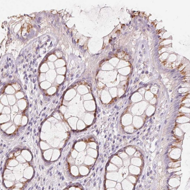 Immunohistochemical staining of human rectum shows moderate, granular cytoplasmic positivity in glandular cells.