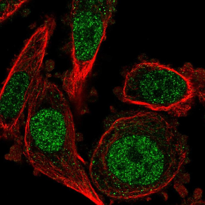 Immunofluorescent staining of human cell line PC-3 shows localization to nucleoplasm.
