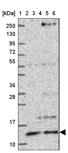 Lane 1: Marker [kDa] 250, 130, 95, 72, 55, 36, 28, 17, 10<br/>Lane 2: Human cell line RT-4<br/>Lane 3: Human cell line U-251 MG<br/>Lane 4: Human plasma<br/>Lane 5: Human Liver tissue<br/>Lane 6: Human Tonsil tissue