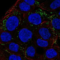 Immunofluorescent staining of human cell line OE19 shows localization to vesicles.