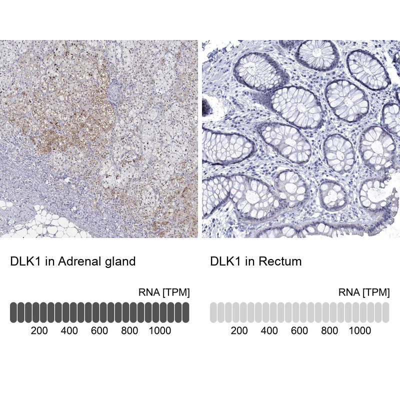 Immunohistochemistry analysis in human adrenal gland and rectum tissues using HPA062262 antibody. Corresponding DLK1 RNA-seq data are presented for the same tissues.