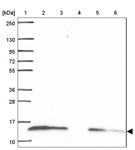 Lane 1: Marker [kDa] 250, 130, 95, 72, 55, 36, 28, 17, 10<br/>Lane 2: Human cell line RT-4<br/>Lane 3: Human cell line U-251 MG<br/>Lane 4: Human plasma<br/>Lane 5: Human Liver tissue<br/>Lane 6: Human Tonsil tissue