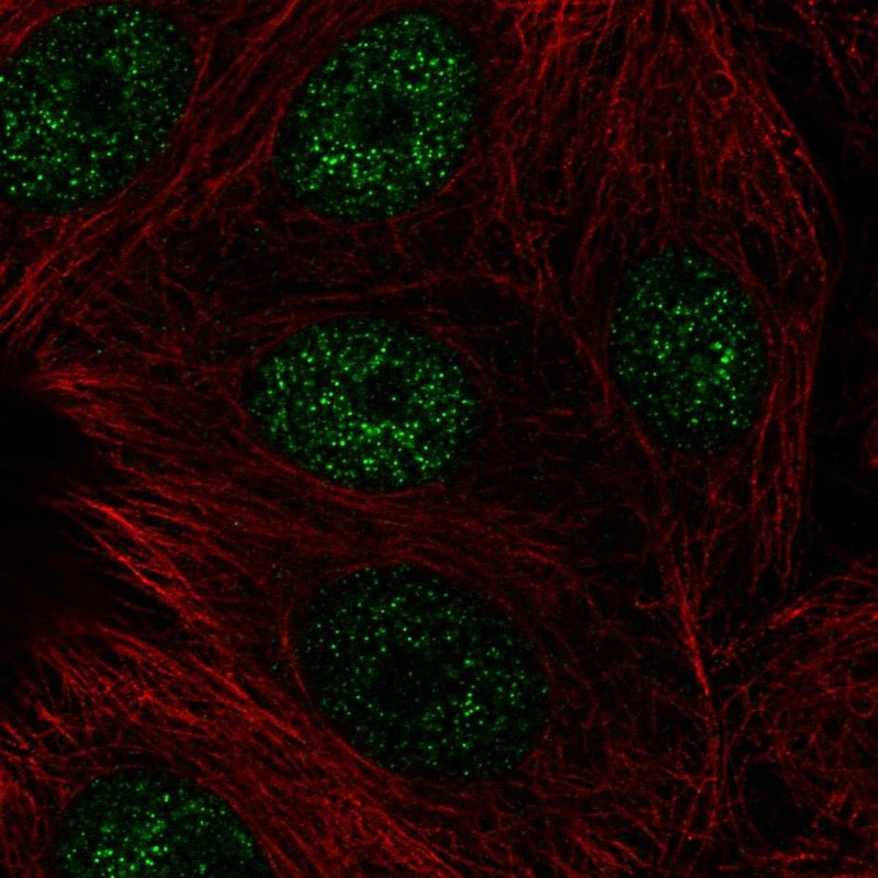 Immunofluorescent staining of human cell line MCF7 shows localization to nucleoplasm.
