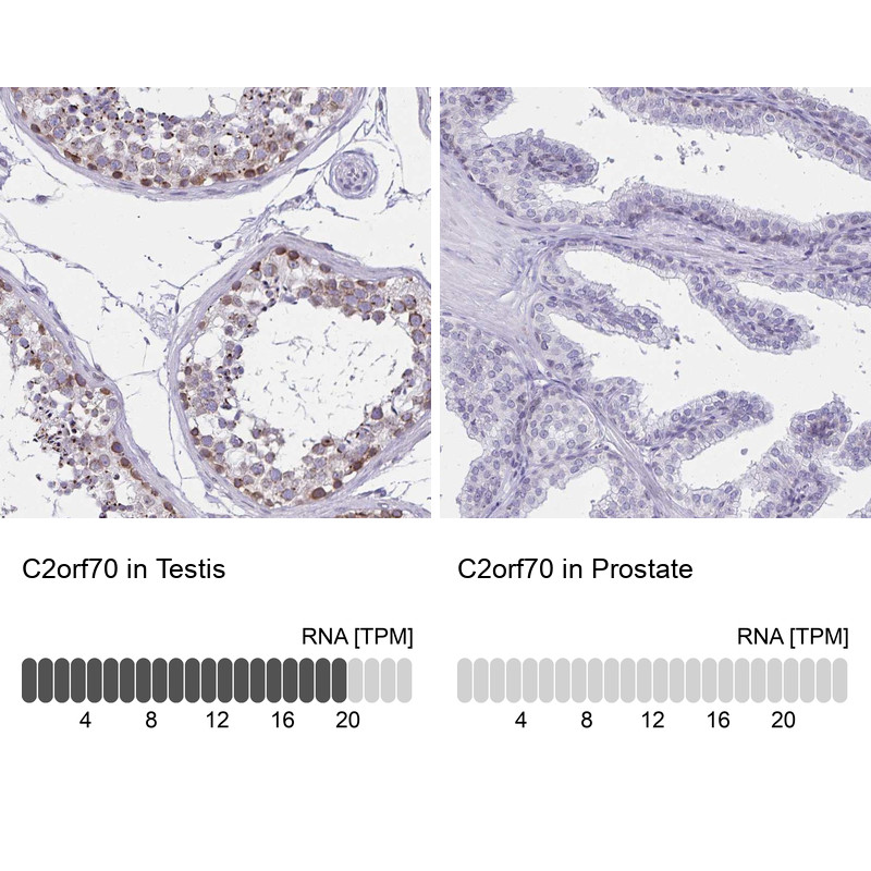Immunohistochemistry analysis in human testis and prostate tissues using Anti-C2orf70 antibody. Corresponding C2orf70 RNA-seq data are presented for the same tissues.