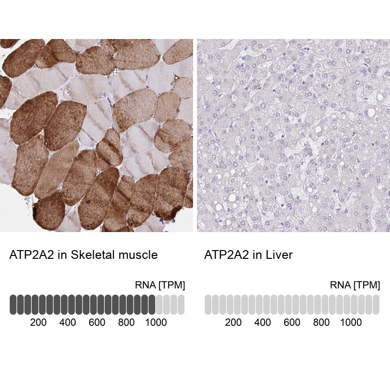 Immunohistochemistry analysis in human skeletal muscle and liver tissues using HPA062605 antibody. Corresponding ATP2A2 RNA-seq data are presented for the same tissues.