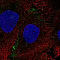 Immunofluorescent staining of human cell line HaCaT shows localization to plasma membrane.