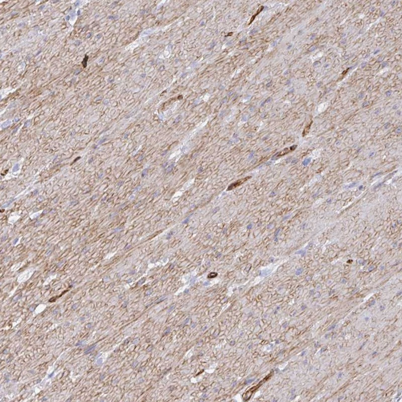 Immunohistochemical staining of human smooth muscle shows moderate cytoplasmic and membranous positivity in smooth muscle cells.