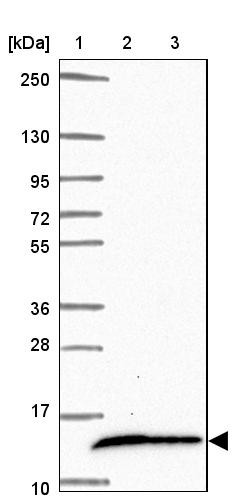 Lane 1: Marker [kDa] 250, 130, 95, 72, 55, 36, 28, 17, 10<br/>Lane 2: Human cell line RT-4<br/>Lane 3: Human cell line U-251MG sp