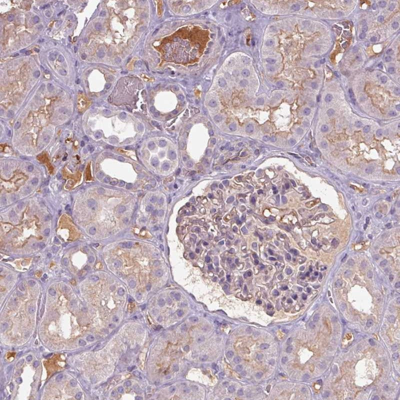 Immunohistochemical staining of human kidney shows moderate membranous positivity in cells in tubules along with distinctly stained extracellular material/ Plasma.