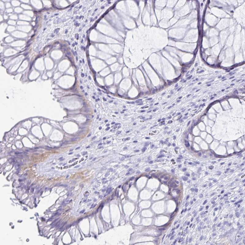 Immunohistochemical staining of human rectum shows weak cytoplasmic positivity in glandular cells.
