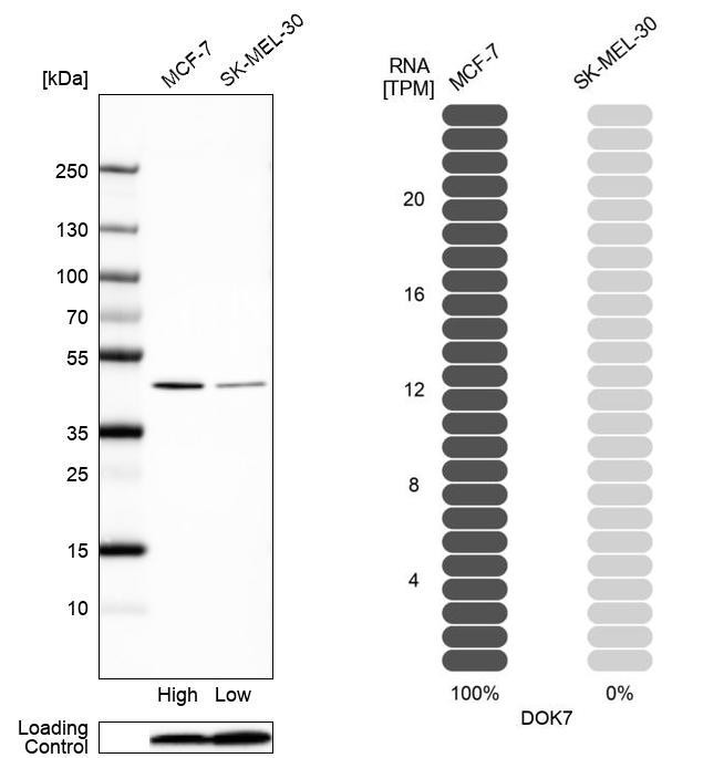 Western blot analysis in human cell line MCF-7 and human cell line SK-MEL-30.