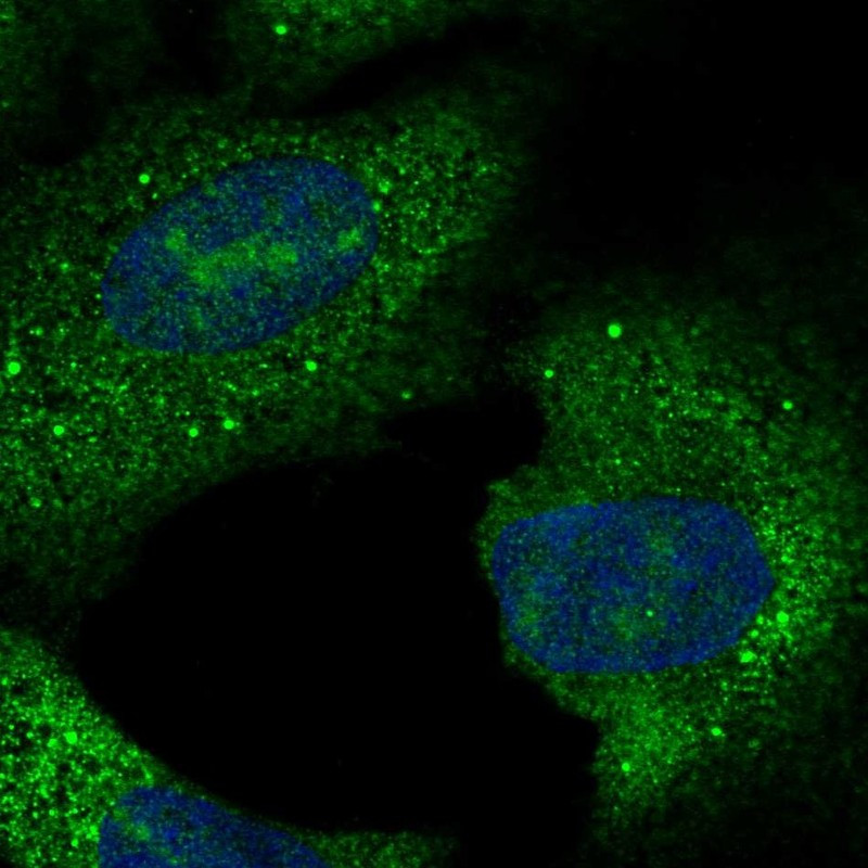 Immunofluorescent staining of human cell line U-2 OS shows localization to nucleoli, cytosol & vesicles.