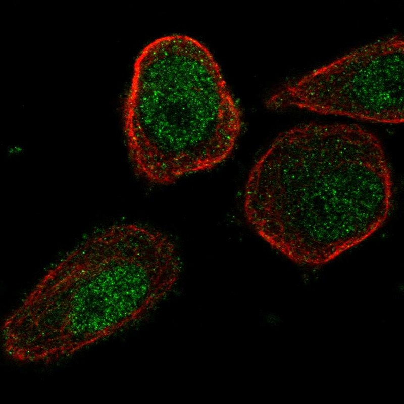Immunofluorescent staining of human cell line PC-3 shows localization to nucleoplasm & cytosol.