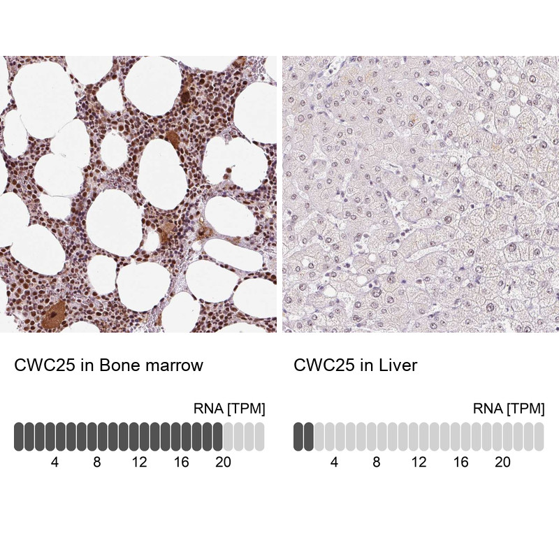 Immunohistochemistry analysis in human bone marrow and liver tissues using Anti-CWC25 antibody. Corresponding CWC25 RNA-seq data are presented for the same tissues.