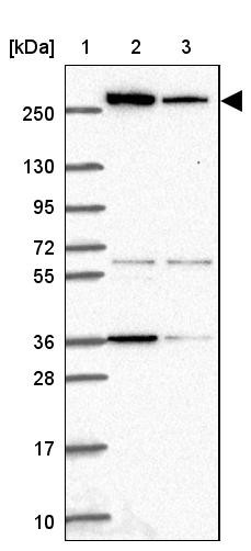 Lane 1: Marker [kDa] 250, 130, 95, 72, 55, 36, 28, 17, 10<br/>Lane 2: Human cell line RT-4<br/>Lane 3: Human cell line U-251 MG