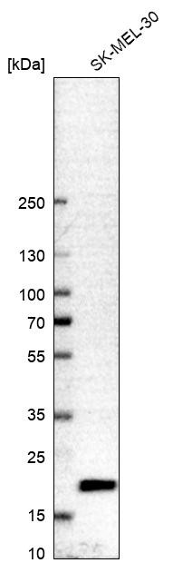 Western blot analysis in human cell line SK-MEL-30.
