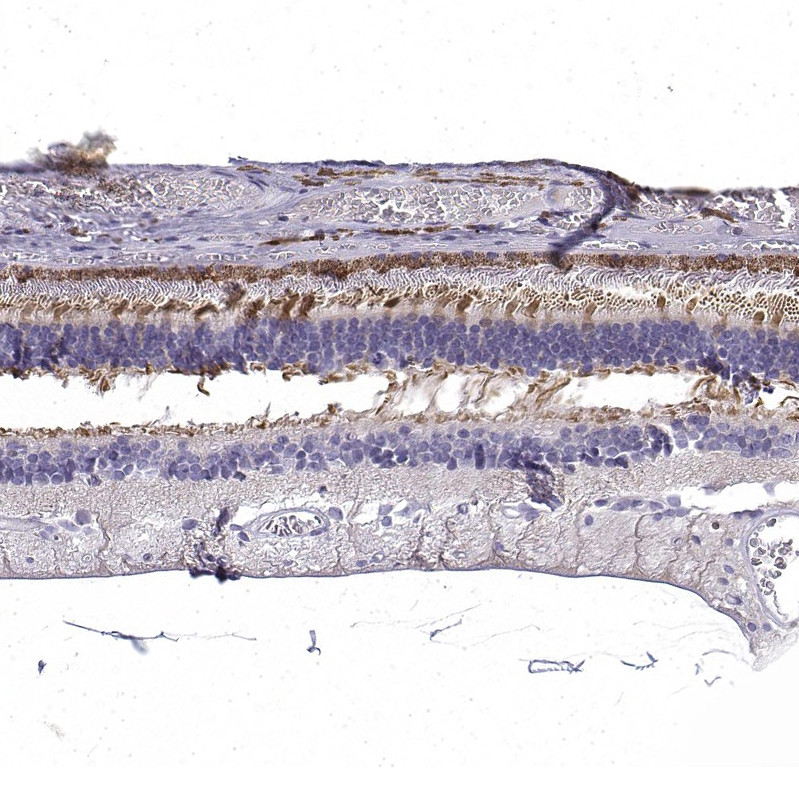 Immunohistochemical staining of human eye, retina shows moderate cytoplasmic positivity in photoreceptor cells and outer plexiform layer.