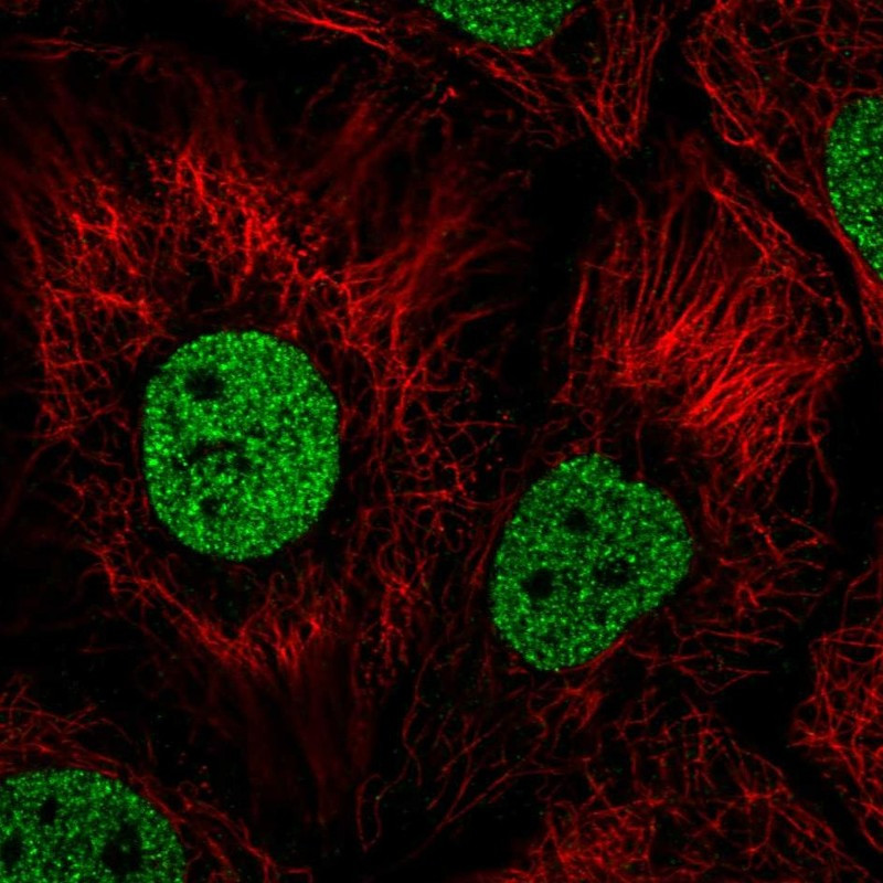 Immunofluorescent staining of human cell line HaCaT shows localization to nucleoplasm.