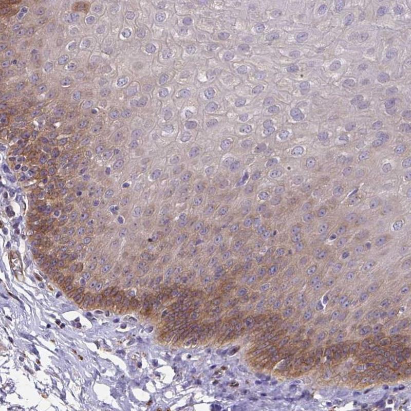Immunohistochemical staining of human esophagus shows moderate cytoplasmic positivity in squamous epithelial cells.