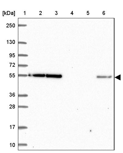 Lane 1: Marker [kDa] 250, 130, 95, 72, 55, 36, 28, 17, 10<br/>Lane 2: Human cell line RT-4<br/>Lane 3: Human cell line U-251 MG<br/>Lane 4: Human plasma<br/>Lane 5: Human Liver tissue<br/>Lane 6: Human Tonsil tissue