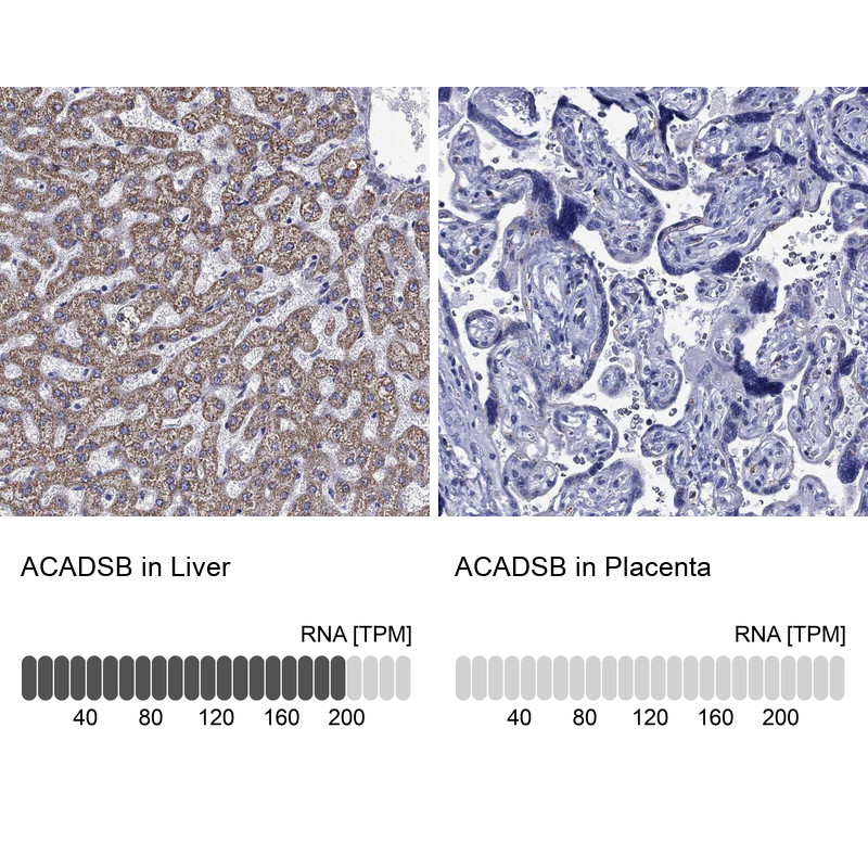 Immunohistochemistry analysis in human liver and placenta tissues using Anti-ACADSB antibody. Corresponding ACADSB RNA-seq data are presented for the same tissues.