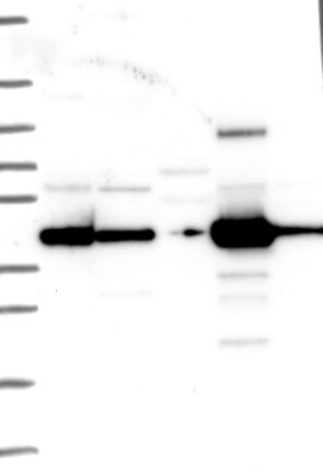 Lane 1: Marker [kDa] 250, 130, 95, 72, 55, 36, 28, 17, 10 | Lane 2: RT4 | Lane 3: U-251 MG | Lane 4: Human Plasma | Lane 5: Liver | Lane 6: Tonsil