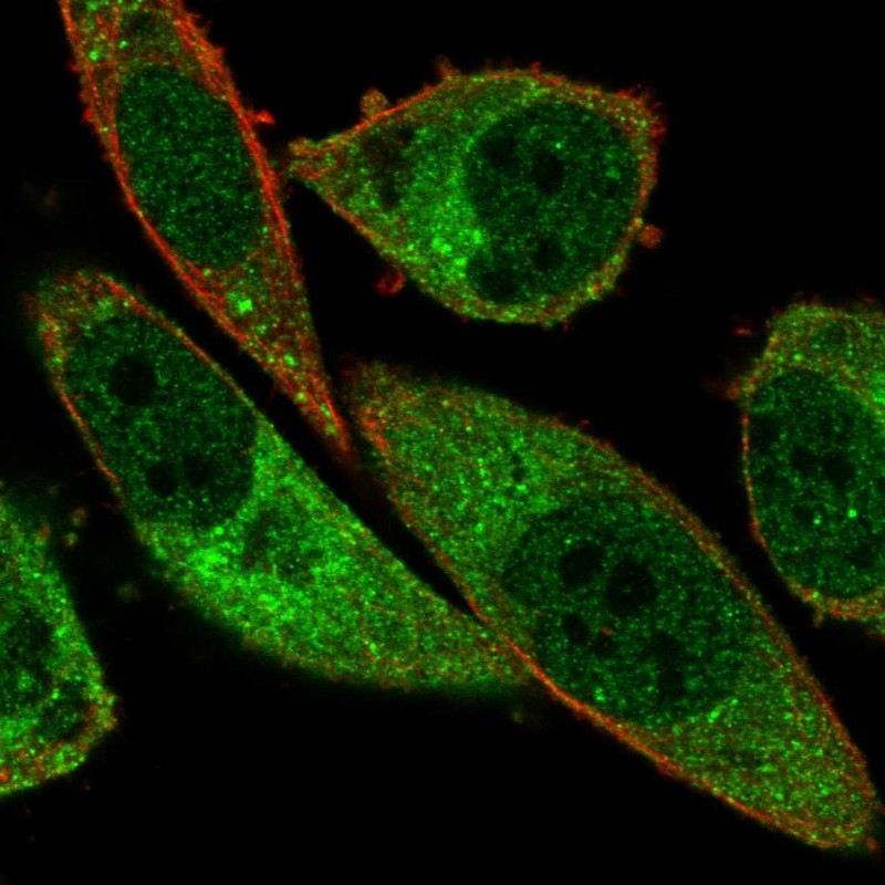 Immunofluorescent staining of human cell line PC-3 shows localization to nucleoplasm, cytosol & vesicles.