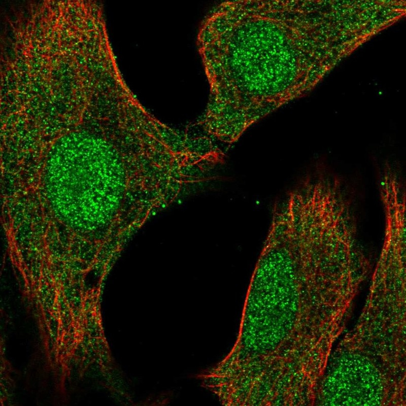 Immunofluorescent staining of human cell line A549 shows localization to nucleoplasm & cytosol.