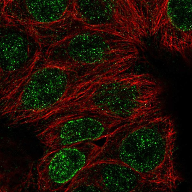Immunofluorescent staining of human cell line MCF7 shows localization to nucleoplasm & nuclear membrane.