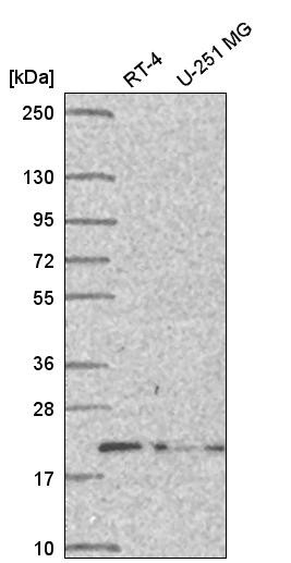 Western blot analysis in human cell line RT-4 and human cell line U-251 MG.