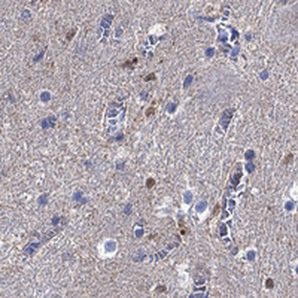 Immunohistochemical staining of human cerebellum shows cytoplasmic positivity in dentate nucleus.