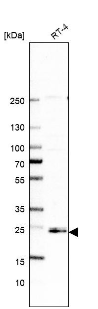 Western blot analysis in human cell line RT-4.