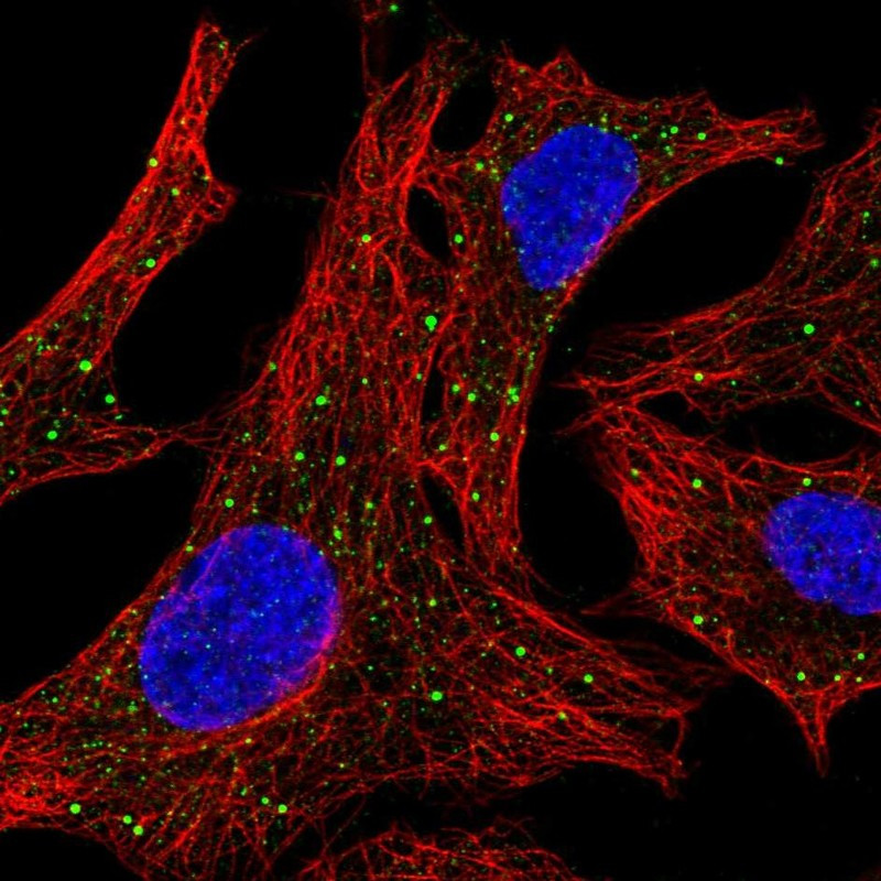 Immunofluorescent staining of human cell line A549 shows localization to lipid droplets.