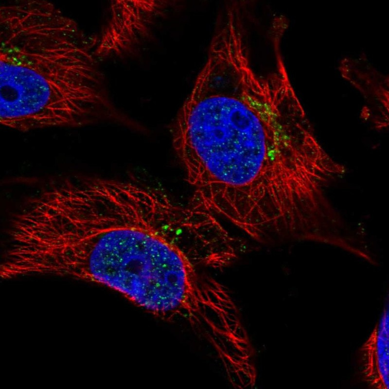Immunofluorescent staining of human cell line U-251 MG shows localization to the Golgi apparatus.