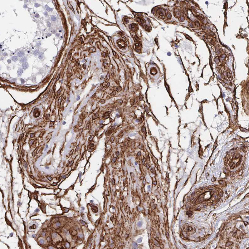 Immunohistochemical staining of human testis shows strong membranous positivity in Leydig cells.