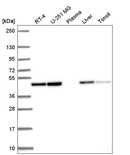 Western blot analysis in human cell line RT-4, human cell line U-251 MG, human plasma, human liver tissue and human tonsil tissue.