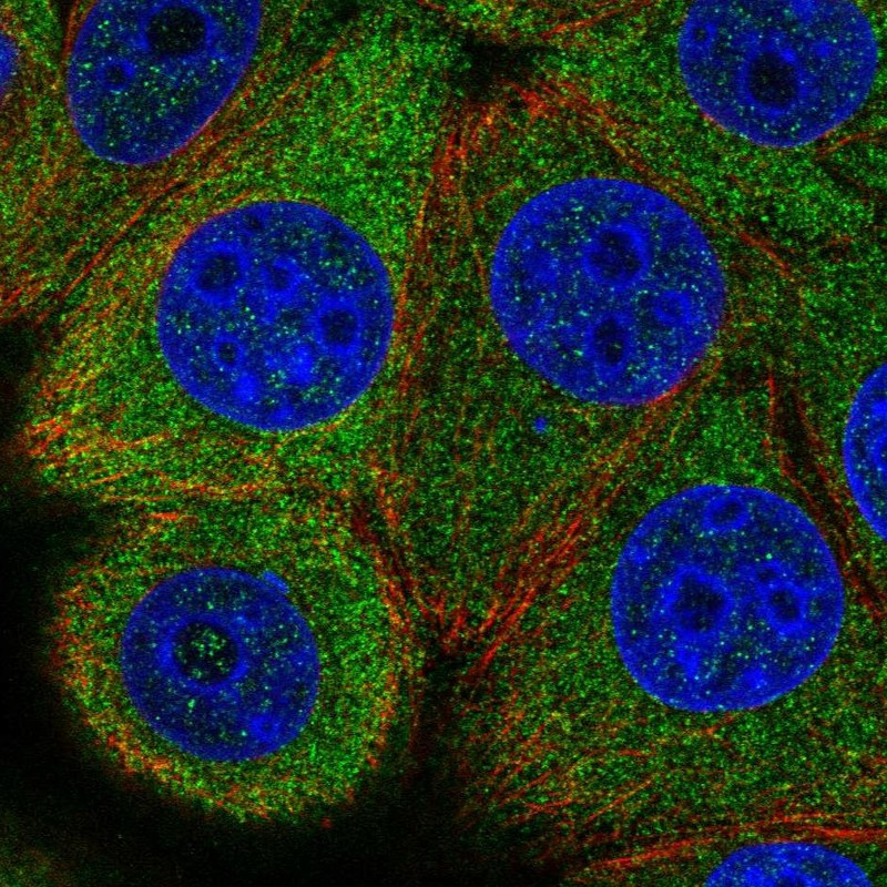 Immunofluorescent staining of human cell line MCF7 shows localization to cytosol.