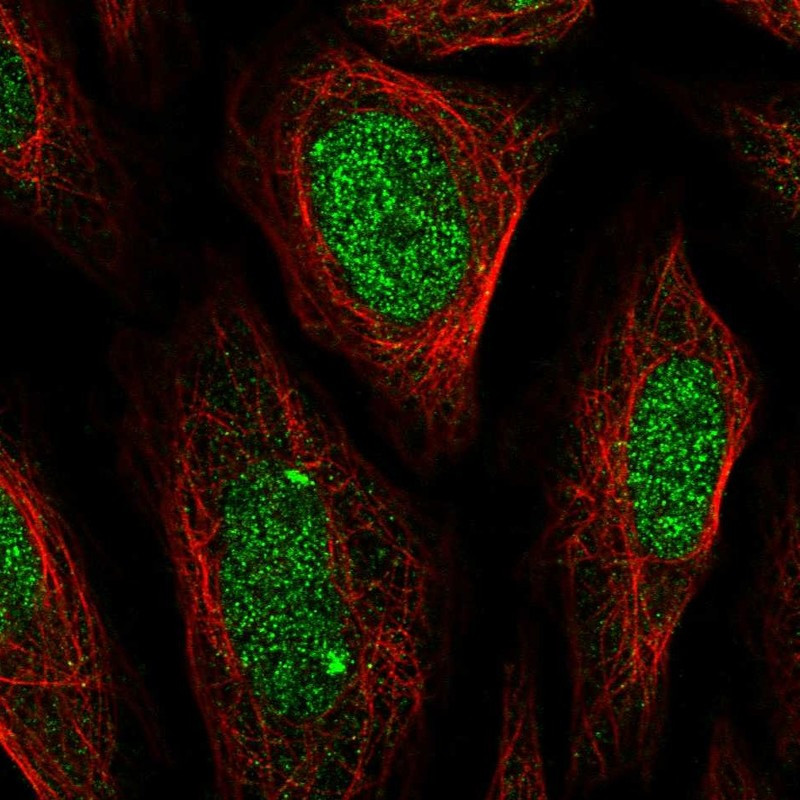 Immunofluorescent staining of human cell line SiHa shows localization to nucleoplasm.
