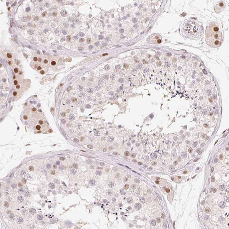 Immunohistochemical staining of human testis shows strong nuclear positivity in Leydig cells.