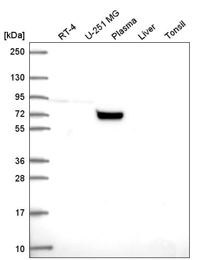 Western blot analysis in human cell line RT-4, human cell line U-251 MG, human plasma, human liver tissue and human tonsil tissue.
