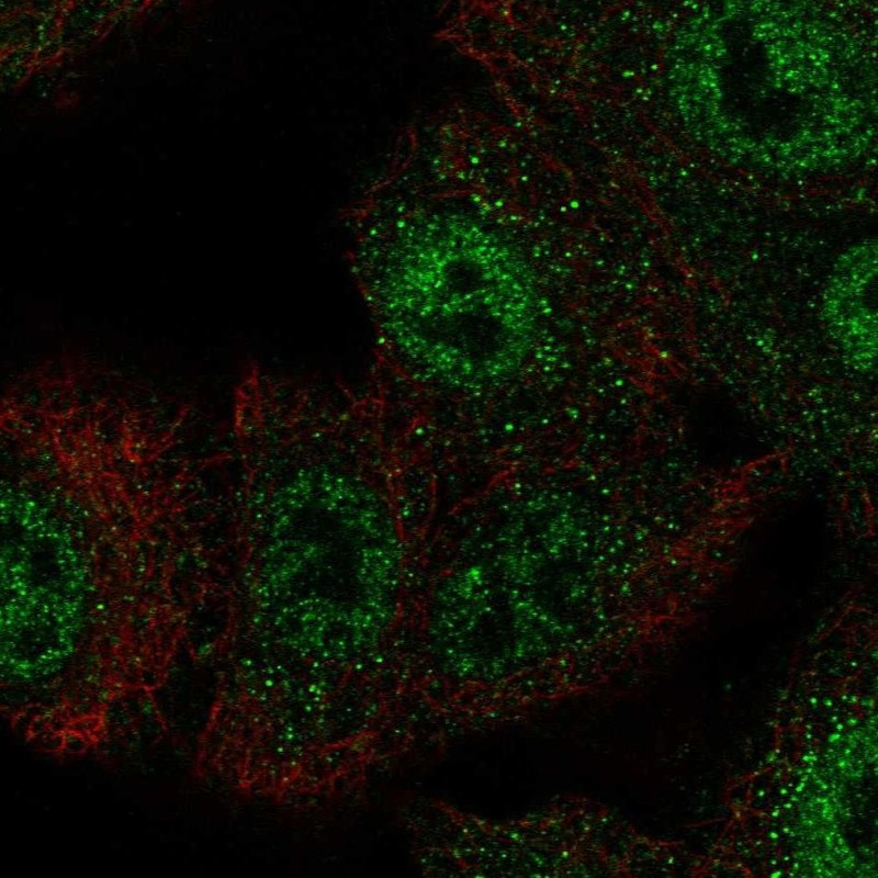 Immunofluorescent staining of human cell line A549 shows localization to nucleoplasm & vesicles.