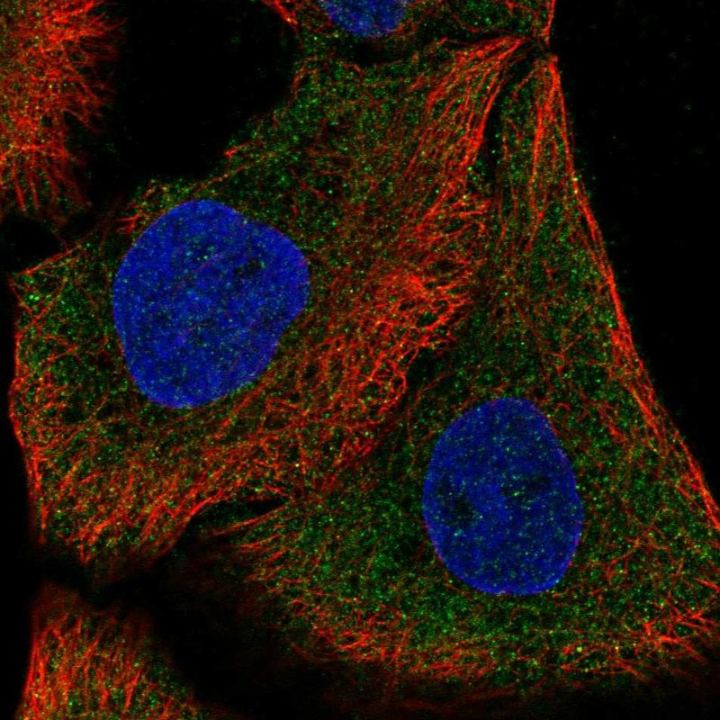 Immunofluorescent staining of human cell line HaCaT shows localization to cytosol.